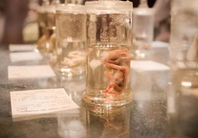 详细解读西宁市做长方案试管婴儿费用，长方案和短方案成功率有差别吗？