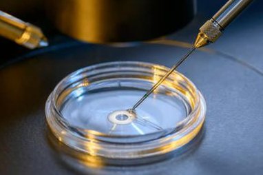 试管打夜针后需要做的检查项目清单：性激素六项必不可少