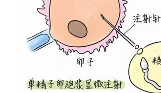 试管婴儿治疗中的RFG优势：更高的成功率和更多的选择