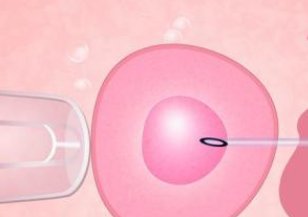 染色体异常不孕能在成都西囡妇科医院做三代试管怀孩子吗？男人染色体有问题能做试管吗？