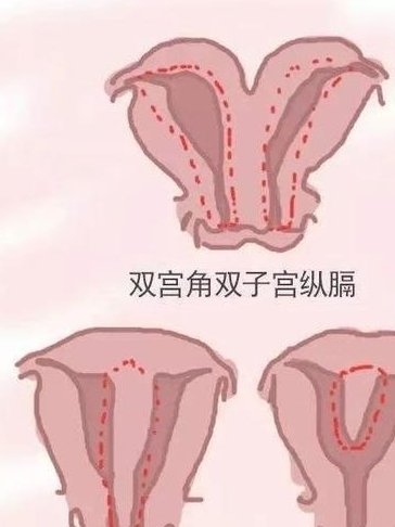 天津地区有哪些私立的机构可以做试管技术？40岁大龄试管需要羊穿吗？