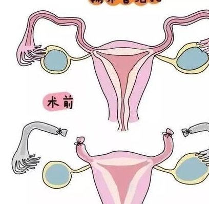 在国外生孩子要多少钱？费用因情况而异!