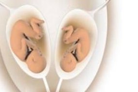 在湘潭市做试管婴儿长方案周期需要多久？超长方案促排流程是怎么样的？